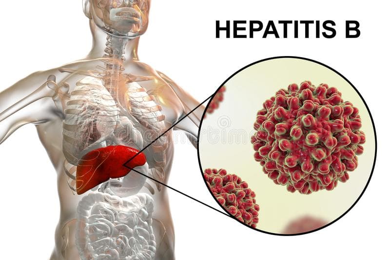 Hepatitis B